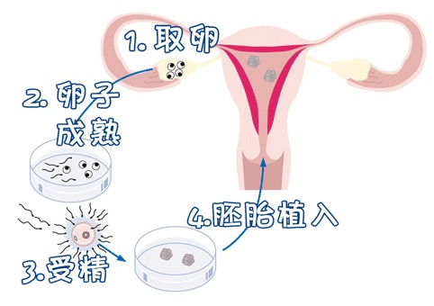 借精试管助孕生殖医学中心